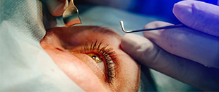 Medical eye care at Stites Eye Care